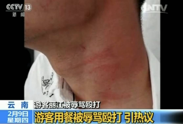 游客丽江就餐被辱骂殴打 真相到底是什么？